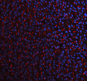 Cadherin 2 Antibody Rat Heart Tissue IF. Immunofluorescent staining of FFPE rat heart tissue with Cadherin 2 Antibody at 5 ug/ml demonstrates CDH2 expression (red). Heat-induced epitope retrieval was performed in pH8 EDTA buffer, followed by blocking with 10% goat serum. Sections were incubated with primary antibody overnight at 4Â°C, followed by Cy3-conjugated secondary antibody, with DAPI nuclear counterstain (blue). Red fluorescence demonstrates Cadherin 2 localization within the cardiac tissue. This Cadherin 2 Antibody, also called CDH2 Antibody, supports studies of N-Cadherin expression, cell-cell adhesion, and cardiac tissue biology.