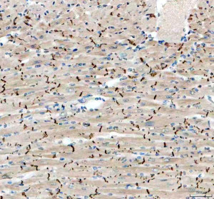 Cadherin 2 Antibody Mouse Heart IHC. Immunohistochemical staining of FFPE mouse heart tissue with Cadherin 2 Antibody at 2 ug/ml demonstrates CDH2 expression. Heat-induced epitope retrieval was performed in pH8 EDTA buffer, followed by blocking with 10% goat serum. Sections were incubated with primary antibody overnight at 4Â°C and developed with DAB chromogen. Distinct brown staining is observed at cell-cell junctions within the cardiac tissue, consistent with N-Cadherin localization in cardiomyocytes. This Cadherin 2 Antibody, also called CDH2 Antibody, supports studies of N-Cadherin expression, cardiac cell adhesion, and intercalated disc organization.