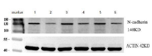 Cadherin 2 Antibody Human Cervical Cancer WB. Western blot analysis of paired human cervical cancer and adjacent tissue lysates with Cadherin 2 Antibody at 1:1000. Lanes 1, 3, and 5 contain cervical cancer tissue lysates; lanes 2, 4, and 6 contain corresponding adjacent tissue lysates. A prominent band is detected at approximately 140 kDa, consistent with the expected molecular weight of approximately 150 kDa for N-Cadherin/CDH2. Actin at approximately 42 kDa is shown as a loading control. This Cadherin 2 Antibody, also called CDH2 Antibody, supports studies of N-Cadherin expression, epithelial-mesenchymal transition, and cervical cancer biology.