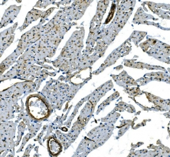 IHC staining of FFPE rat heart with Cadherin 13 antibody. HIER: boil tissue sections in pH8 EDTA for 20 min and allow to cool before testing.
