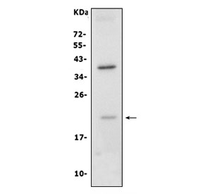 Claudin 7 Antibody Caco-2 WB. Western blot analysis of human Caco-2 cell lysate using Claudin 7 Antibody detects a band at approximately 20-25 kDa, consistent with the predicted molecular weight of Claudin 7, along with an additional band near ~35-40 kDa, which may reflect dimerization, post-translational modification, or SDS-resistant oligomeric forms commonly observed for tight junction proteins.
