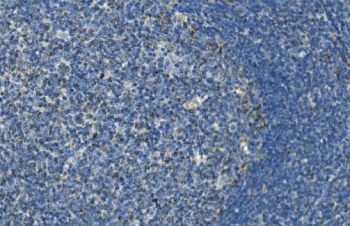 IHC staining of FFPE human tonsil with Interleukin 37 antibody. HIER: boil tissue sections in pH8 EDTA for 20 min and allow to cool before testing.