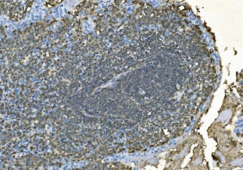 IHC staining of FFPE human tonsil with CD20 antibody. HIER: boil tissue sections in pH8 EDTA for 20 min and allow to cool before testing.