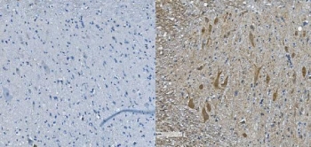 IHC staining of FFPE mouse spinal cord (right) and negative control (left) with Neurofilament Light antibody. HIER: boil tissue sections in pH8 EDTA for 20 min and allow to cool before testing.