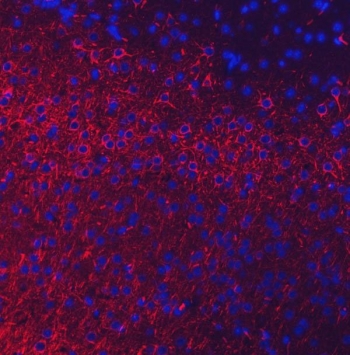 Immunofluorescent staining of FFPE mouse brain tissue with Neurofilament Light antibody (red) and DAPI nuclear stain (blue). HIER: boil tissue sections in pH8 EDTA for 20 min and allow to cool before testing.