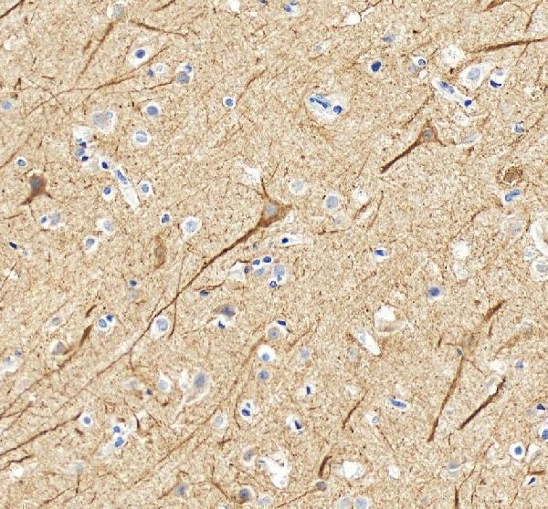 Neurofilament Light Antibody Human Brain IHC. Immunohistochemical staining of FFPE human brain tissue with Neurofilament Light antibody at 2 ug/ml. Heat-induced epitope retrieval (HIER) was performed by boiling tissue sections in pH 8 EDTA buffer prior to staining. Neurofilament Light immunoreactivity is observed within neuronal cell bodies and extensive axonal processes, consistent with the expected localization of this neuronal intermediate filament protein that provides structural support for axons and helps maintain neuronal architecture. Cell nuclei are counterstained with hematoxylin (blue).