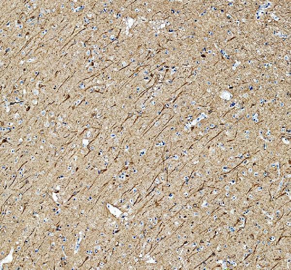 Neurofilament Light Antibody Human Hippocampus IHC. Immunohistochemical staining of FFPE human hippocampus tissue with Neurofilament Light antibody at 2 ug/ml. Heat-induced epitope retrieval (HIER) was performed by boiling tissue sections in pH 8 EDTA buffer prior to staining. Neurofilament Light immunoreactivity is observed within neuronal cell bodies and extensive axonal processes throughout the hippocampus, consistent with the expected localization of this neuronal intermediate filament protein that provides structural support for axons and helps maintain neuronal architecture. Cell nuclei are counterstained with hematoxylin (blue).