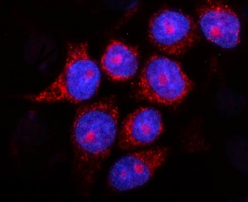 PSEN2 Antibody MCF7 IF. Immunofluorescent staining of FFPE human MCF7 cells with PSEN2 antibody (green) and DAPI nuclear stain (blue). HIER: steam section in pH6 citrate buffer for 20 min.