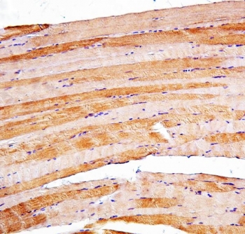 PSEN2 Antibody Skeletal Muscle IHC. Immunohistochemistry staining of FFPE human skeletal muscle with PSEN2 antibody. HIER: boil tissue sections in pH8 EDTA for 20 min and allow to cool before testing.