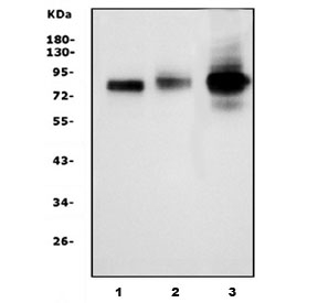 HCAM Antibody Human and Rat Sample WB. Western blot testing of 1) human HeLa, 2) human A549 and 3) rat C6 cell lysate with HCAM antibody. Predicted molecular weight ~81 kDa.