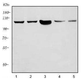 PARP1 Antibody Multi-Species Tissue WB. Western blot analysis of human, rat, and mouse lysates using PARP1 antibody. Lane 1: human MCF7 lysate, Lane 2: human HeLa lysate, Lane 3: human HEK293 lysate, Lane 4: rat testis lysate, Lane 5: mouse testis lysate. A prominent band is detected near 116 kDa, consistent with the predicted molecular weight of full-length PARP1. The broad cross-species detection pattern supports the conserved chromatin-associated role of PARP1 in DNA repair, genomic stability maintenance, and nuclear stress-response signaling pathways across proliferative mammalian tissues and cell lines.