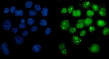 PARP1 Antibody A431 Cell IF. Immunofluorescent staining of FFPE human A431 cells with PARP1 antibody (green) and DAPI nuclear stain (blue). HIER: steam section in pH6 citrate buffer for 20 min.