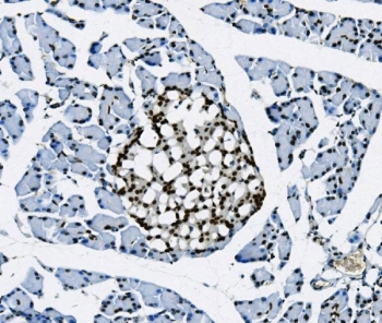 IHC staining of FFPE rat pancreas with TKT antibody. HIER: boil tissue sections in pH8 EDTA for 20 min and allow to cool before testing.
