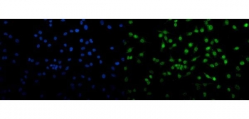 Immunofluorescent staining of FFPE human A549 cells with Transketolase antibody (green) and DAPI nuclear stain (blue). HIER: steam section in pH6 citrate buffer for 20 min.
