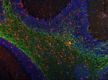 SIGLEC-4a Antibody Rat Cerebellum IF. Immunofluorescent staining of FFPE rat cerebellum tissue using SIGLEC-4a antibody (green) with GFAP antibody (red) and DAPI nuclear counterstain (blue). Heat-induced epitope retrieval was performed in pH6 citrate buffer, followed by incubation with the primary antibodies and fluorescent secondary antibodies. SIGLEC-4a immunoreactivity is prominently localized within the cerebellar white matter, consistent with expression in myelinating glial cells, while GFAP labels astrocytes. This result demonstrates that SIGLEC-4a antibody, also known as a Sialic Acid Binding Immunoglobulin Like Lectin 4A antibody, is suitable for immunofluorescence analysis of rat nervous tissue.