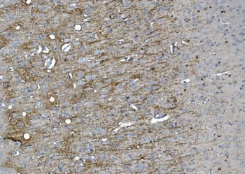 SIGLEC-4a Antibody Rat Brain IHC. IHC staining of FFPE rat brain tissue using SIGLEC-4a antibody. Heat-induced epitope retrieval was performed in pH8 EDTA buffer before incubation with the primary antibody, followed by HRP secondary antibody and DAB chromogen. Strong immunoreactivity is observed within myelinated white matter tracts, while adjacent gray matter exhibits comparatively weaker staining, consistent with the distribution of myelin-associated glycoprotein in the central nervous system. This result demonstrates that SIGLEC-4a antibody, also known as a Sialic Acid Binding Immunoglobulin Like Lectin 4A antibody, is suitable for immunohistochemical detection of myelin-associated structures in rat brain tissue.
