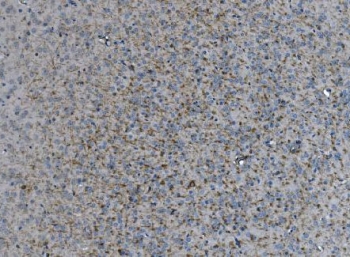 SIGLEC-4a Antibody Mouse Brain IHC. IHC staining of FFPE mouse brain tissue using SIGLEC-4a antibody. Heat-induced epitope retrieval was performed in pH8 EDTA buffer before incubation with the primary antibody, followed by HRP secondary antibody and DAB chromogen. Diffuse membranous and cytoplasmic immunoreactivity is observed throughout myelin-rich regions of the brain, consistent with the expression pattern of myelin associated glycoprotein in oligodendrocytes and myelinated fibers. This result demonstrates that SIGLEC-4a antibody, also known as a Sialic Acid Binding Immunoglobulin Like Lectin 4A antibody, is suitable for immunohistochemical detection of myelin-associated proteins in mouse brain tissue.
