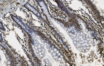 IHC staining of FFPE rat intestine with U2AF65 antibody. HIER: boil tissue sections in pH8 EDTA for 20 min and allow to cool before testing.