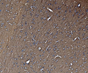 IHC staining of FFPE rat brain with TUBA1 antibody. HIER: boil tissue sections in pH8 EDTA for 20 min and allow to cool before testing.
