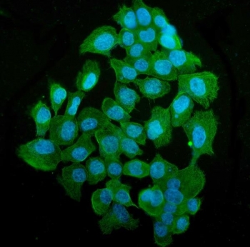 Immunofluorescent staining of FFPE human A431 cells with TUBA1 antibody (green) and DAPI nuclear stain (blue). HIER: steam section in pH6 citrate buffer for 20 min.