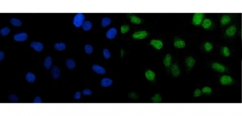 Immunofluorescent staining of FFPE human U-2 OS cells with PTBP2 antibody (green) and DAPI nuclear stain (blue). HIER: steam section in pH6 citrate buffer for 20 min.