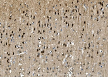 IHC staining of FFPE rat brain with TORC1/CRTC1 antibody. HIER: boil tissue sections in pH8 EDTA for 20 min and allow to cool before testing.