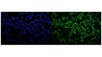 Immunofluorescent staining of FFPE human MCF7 cells with hnRNP H3 antibody (green) and DAPI nuclear stain (blue). HIER: steam section in pH6 citrate buffer for 20 min.