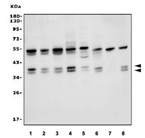 Western blot testing of human 1) Jurkat, 2) PC-3, 3) Raji, 4) K562, 5) Caco-2, 6) MCF7, 7) HL-60 and 8) a second lot of PC-3 cell lysate with hnRNP H3 antibody. Predicted molecular weight: 35 kDa and 37 kDa.