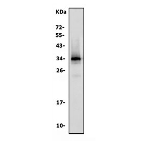 Western blot testing of human LNCaP cell lysate with polyclonal PSA antibody. Expected molecular weight: 30-40 kDa.