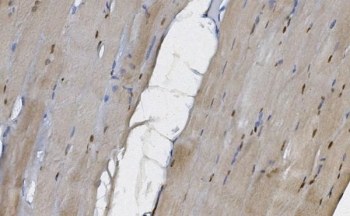 IHC staining of FFPE human skeletal muscle with MEK5 antibody. HIER: boil tissue sections in pH8 EDTA for 20 min and allow to cool before testing.