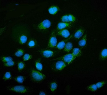 NCAM1 Antibody for IF. Immunofluorescence analysis of FFPE human U-2 OS cells shows green fluorescence corresponding to Neural cell adhesion molecule 1 (NCAM1), also known as CD56. Signal is detected predominantly along the cell periphery with punctate cytoplasmic staining consistent with localization of this membrane-associated adhesion molecule. DAPI counterstain (blue) marks cell nuclei for reference. The staining pattern highlights NCAM1-positive cells within the population and illustrates the ability of this antibody to visualize CD56 expression by immunofluorescence microscopy. Heat-induced epitope retrieval was performed by steaming sections in pH6 citrate buffer for 20 minutes prior to antibody incubation.