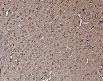 IHC staining of FFPE rat brain with PFN2 antibody. HIER: boil tissue sections in pH8 EDTA for 20 min and allow to cool before testing.