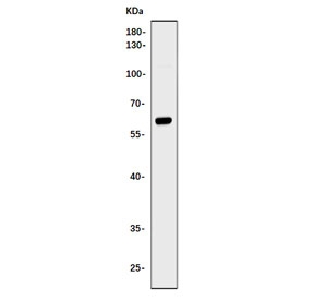 Western blot testing of human U-2 OS cell lysate with PHF21B antibody. Predicted molecular weight ~57 kDa.