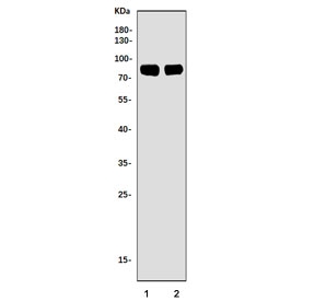 Western blot testing of 1) rat brain and 2) mouse brain tissue lysate with cPLA2-beta antibody. Predicted molecular weight ~88 kDa.