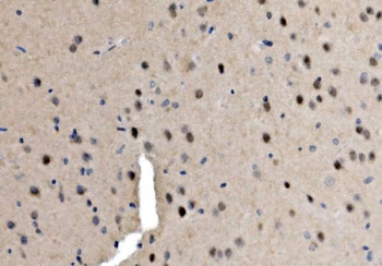 IHC staining of FFPE mouse brain with Serum Response Factor antibody. HIER: boil tissue sections in pH8 EDTA for 20 min and allow to cool before testing.