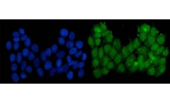 Immunofluorescent staining of FFPE human MCF7 cells with Serum Response Factor antibody (green) and DAPI nuclear stain (blue). HIER: steam section in pH6 citrate buffer for 20 min.