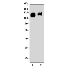 Western blot testing of 1) rat brain and 2) mouse brain lysate with Synaptic vesicle glycoprotein 2A antibody. Predicted molecular weight ~83 kDa but may be observed at larger sizes due to glycosylation. 