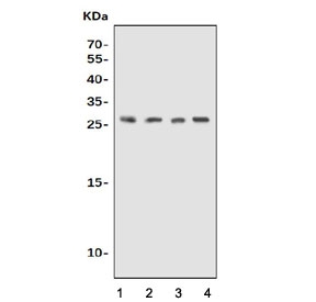 UPK1B Antibody for WB. Western blot analysis of Uroplakin 1B / UPK1B antibody in lysates from 1) human K562 cells, 2) human SK-OV-3 cells, 3) rat stomach tissue, and 4) mouse stomach tissue using UPK1B Antibody / Epithelial Barrier Protein Antibody. A band is detected at approximately 25â30 kDa, consistent with the predicted molecular weight of Uroplakin 1B / UPK1B. The observed band aligns with expression of this epithelial barrier-associated protein, reflecting its role in maintaining urothelial integrity.