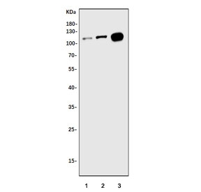 Western blot testing of 1) human placenta, 2) human T-47D and 3) monkey lung tissue lysate with Wolframin antibody. Predicted molecular weight ~100 kDa.