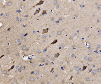 IHC staining of FFPE rat brain tissue with ATG9A antibody. HIER: boil tissue sections in pH8 EDTA for 20 min and allow to cool before testing.