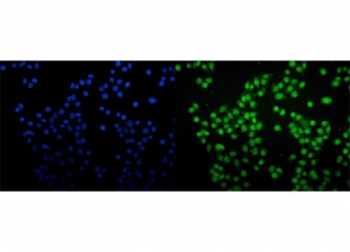 Immunofluorescent staining of FFPE human Caco-2 cells with SAMHD1 antibody (green) and DAPI nuclear stain (blue). HIER: steam section in pH6 citrate buffer for 20 min.