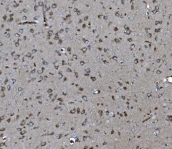 IHC staining of FFPE rat brain tissue with INPPL1 antibody. HIER: boil tissue sections in pH8 EDTA for 20 min and allow to cool before testing.