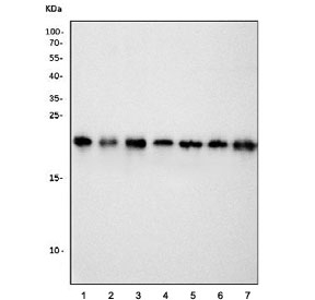 Western blot testing of 1) human U-87 MG, 2) human K562, 3) human Jurkat, 4) rat brain, 5) rat PC-12 and 6) mouse SP2/0 lysate with CBX5 antibody. Predicted molecular weight ~22 kDa.