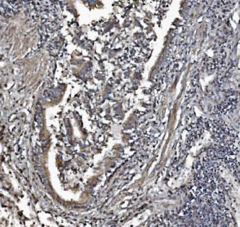 IHC staining of FFPE human lung tissue with Prohibitin 2 antibody. HIER: boil tissue sections in pH8 EDTA for 20 min and allow to cool before testing.