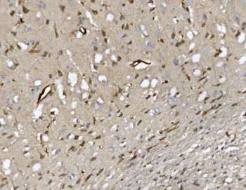 CD34 Antibody Rat Brain IHC. Immunohistochemistry analysis of CD34 expression in FFPE rat brain demonstrates membranous HRP-DAB brown staining in vascular endothelial cells highlighting fine capillary networks and small vessel structures throughout neural tissue, while neuronal and glial cells remain largely negative. The staining pattern supports visualization of cerebral microvasculature and endothelial cell distribution in rat brain. HIER: boil tissue sections in pH8 EDTA for 20 min and allow to cool before testing.