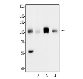 CD34 Antibody Rodent WB. Western blot analysis of CD34 expression in rodent tissue lysates. Lane 1: rat heart lysate, Lane 2: rat skeletal muscle lysate, Lane 3: rat lung lysate, Lane 4: mouse lung lysate. A band is detected at approximately 90-110 kDa, consistent with the predicted molecular weight of CD34 following extensive glycosylation. A lower band near the expected core molecular weight may represent less glycosylated or partially processed forms of the protein. The higher apparent molecular weight reflects known post-translational modification of CD34 as a heavily glycosylated cell surface protein, with stronger signal in lung tissues aligning with endothelial enrichment.