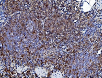 IHC staining of FFPE rat lung lymphoid tissue with Cd226 antibody. HIER: boil tissue sections in pH8 EDTA for 20 min and allow to cool before testing.