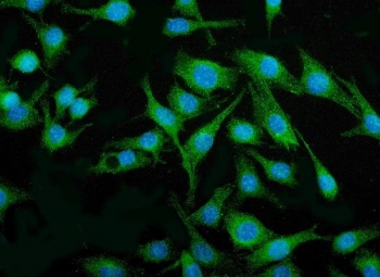 Immunofluorescent staining of FFPE mouse RM-1 cells with Irf3 antibody (green) and DAPI nuclear stain (blue). HIER: steam section in pH6 citrate buffer for 20 min.