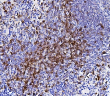 CD5 Antibody for IHC. Immunohistochemistry analysis of CD5 antibody (clone 11B4) staining in FFPE rat spleen tissue using a rat reactive immune marker antibody. Strong membranous staining is observed in lymphocyte populations within splenic white pulp regions, highlighting T cell-rich areas and scattered CD5-positive cells throughout the tissue, while surrounding non-lymphoid areas show minimal staining. The staining pattern reflects expected localization of CD5 in rat lymphoid tissue and supports its use for identifying immune cell distribution in spleen. Heat-induced epitope retrieval was performed using pH 8 EDTA buffer for 20 minutes followed by cooling prior to antibody incubation.