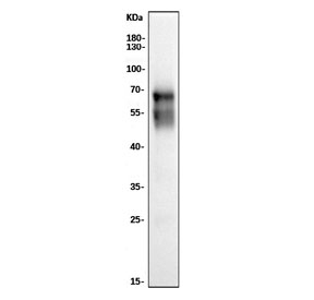 CD5 Antibody for WB. Western blot analysis of CD5 antibody (clone 11B4) in rat thymus lysate using a rat reactive immune marker antibody. A band is detected at approximately 55-67 kDa, consistent with the predicted molecular weight of CD5, with size variation reflecting known glycosylation of this membrane glycoprotein. The strong signal observed in thymus tissue aligns with the high enrichment of CD5 in developing and mature T lymphocytes within this organ.